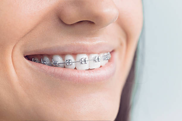 Best Wisdom Tooth Removal  in Fairmead, CA